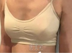 武汉亚韩整形外科医院做丰胸技术如何?能让我满意吗? width=