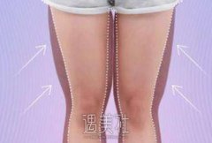 福州腿部吸脂减肥价格大概多少？想知道~ width=