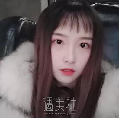 山大二院整形科双眼皮怎么样?亲身经历为你解答!