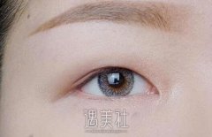 肿眼泡割双眼皮的坏处是什么？想知道~ width=
