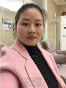大连中心医院做双眼皮果好吗?真实案例为你诠释! width=