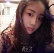 成都艾尚柏雅做双眼皮怎么样?能变得人见人爱吗? width=