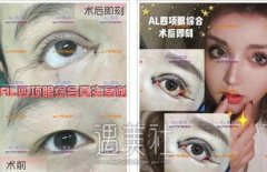 上海al整形医院怎么样？是正规的吗？ width=