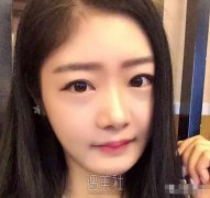 上海华美垫下巴案例|摸着真带劲! width=