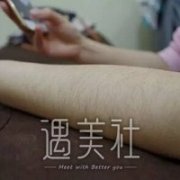 上海九院激光脱毛案例|终于能穿清凉的衣服了! width=