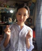 余东做双眼皮修复案例|果人让人羡慕! width=