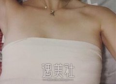 北京润美王明利丰胸案例|眼睛都看直了! width=