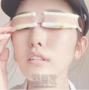 韩勋双眼皮案例|男神终于和我在一起了! width=