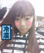 田秋梅隆鼻案例|就此告别糟糕人生! width=
