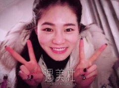 北京京韩乔爱军双眼皮案例|渐渐拥有了自信! width=