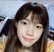 华美整形美容怎么样+全切双眼皮案例 width=