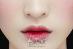 上海九院做嘴角上扬价格大概是多少？ width=