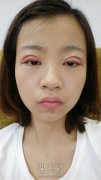 杨明勇的失败案例：真实对比照分享~ width=