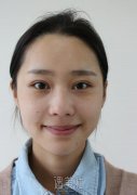陈付国做鼻子好贵|案例前后分享~ width=