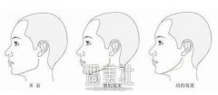 西京整形美容医院价目表正规2020火爆分享~ width=