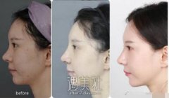 贾德渊和倪云志哪个好?医生介绍 width=