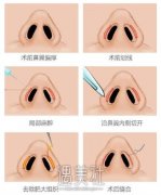 淮南丽人医院整形怎么样?口碑价目表2020分享~ width=