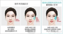 何晋龙磨骨好吗？何晋龙有失败案例吗？ width=