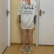 八大处整形医院有失败案例吗?真实吸脂案例曝光! width=