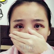 王振军有失败案例吗?做双眼皮技术如何? width=