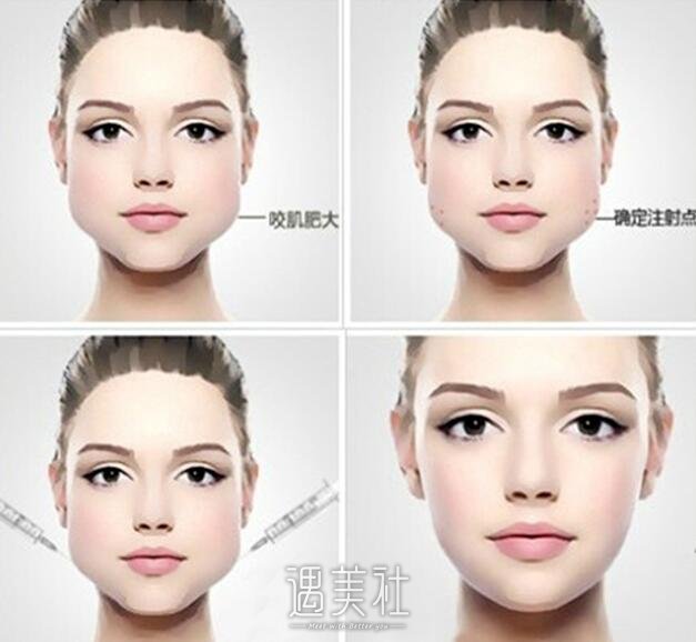 小脸变方脸,90%的人都是发腮了