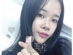 北京三元整形薛红宇怎么样?医生案例+个人资料分享~? width=