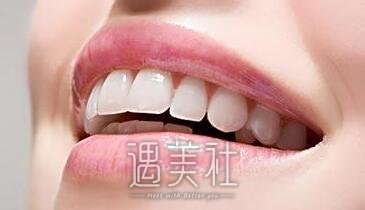上海种植牙价格一般一颗多少钱?是不是很贵啊? width=