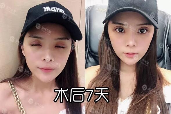 波叔凉凉，《情圣2》撤档，里面可有号称全亚洲较美整形模板啊！