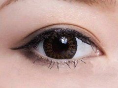 生物焊接双眼皮大概多少钱? width=