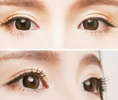 对去美容院割双眼皮说不