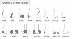隆鼻假体植入的步骤 width=