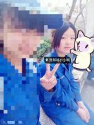 埋线-提升+多方面部自体脂肪移植——摆脱凹凸脸，素颜也很美！ width=
