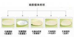 自体脂肪隆胸 彰显性感身材 width=