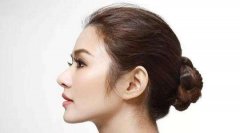 鼻再造术后护理要重视否则因小失大 width=