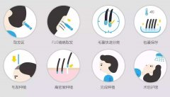 除了植发以外的发量稀疏拯救方法 width=