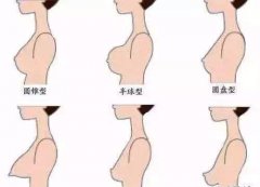 胸小隆胸用什么材料好 width=