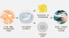 自体脂肪隆胸手术的果好吗？有哪些优势？ width=