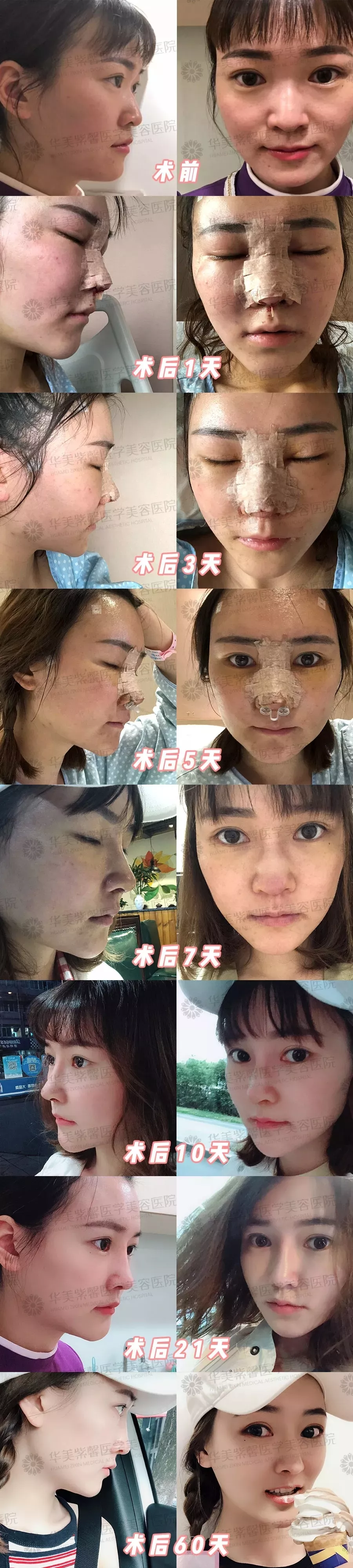 12头身漫画版美少女，整容换头后丑得看不下去？！
