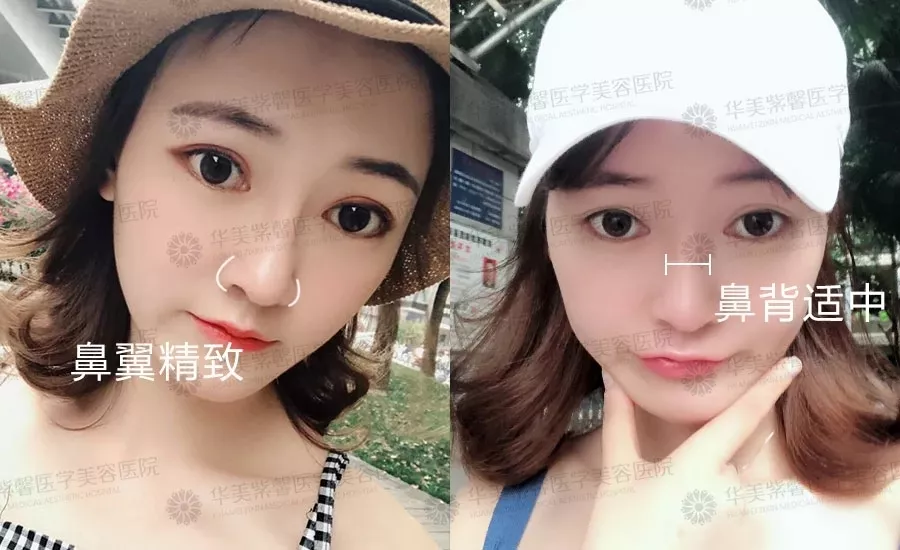 12头身漫画版美少女，整容换头后丑得看不下去？！
