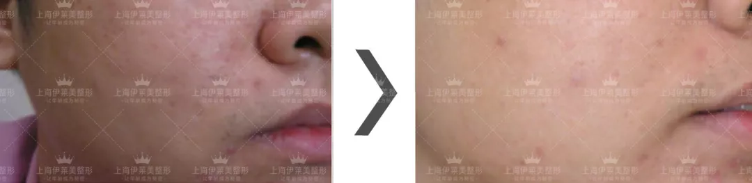 上海伊莱美整形医院有一份情人节攻略，请您注意查收~