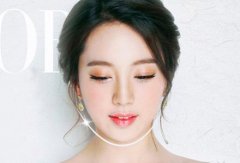打注射瘦脸注射瘦脸大概多少钱? width=