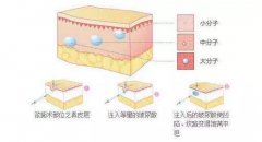 上海注射瘦脸除皱整形多少钱? width=