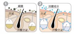 腋臭防不胜防，元凶竟然是你的细菌 width=