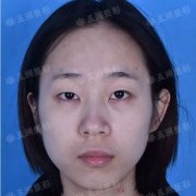 芭比娃娃双眼皮图片有没有？打包发我一份，我妈想看看~ width=