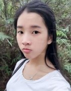 霍氏切开重睑术+内眦赘皮矫正术真实案例一则，小心闪瞎你的眼！ width=