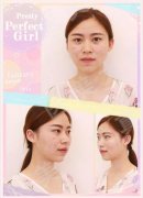 黄金微针又是啥子鬼嘛？这篇日记将告诉你它究竟有好牛啤！ width=