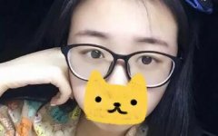cfs芭比大眼术又是个啥子东西哟？我想这个案例能给你展示清楚！ width=