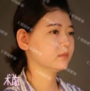 【王绍国案例】注射后，如何能没问题的取出？ width=