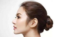 做l形隆鼻手术常用的方法 没问题隆出立体美鼻 width=