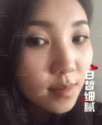 快速祛斑方法有木有？我想这则案例可能会有你感兴趣的内容！ width=